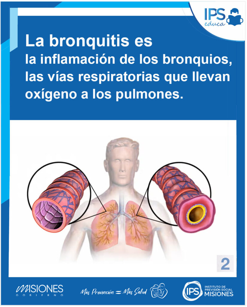 🫁 Bronquitis: conocé sus síntomas y cómo prevenirla imagen-10