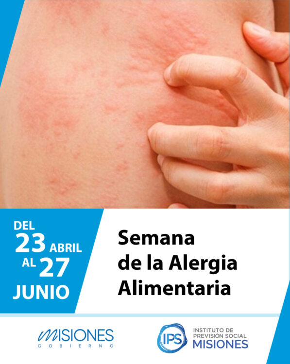 23 al 27 de junio: 🥜🥛🍳 Semana de la Alergia Alimentaria imagen-6