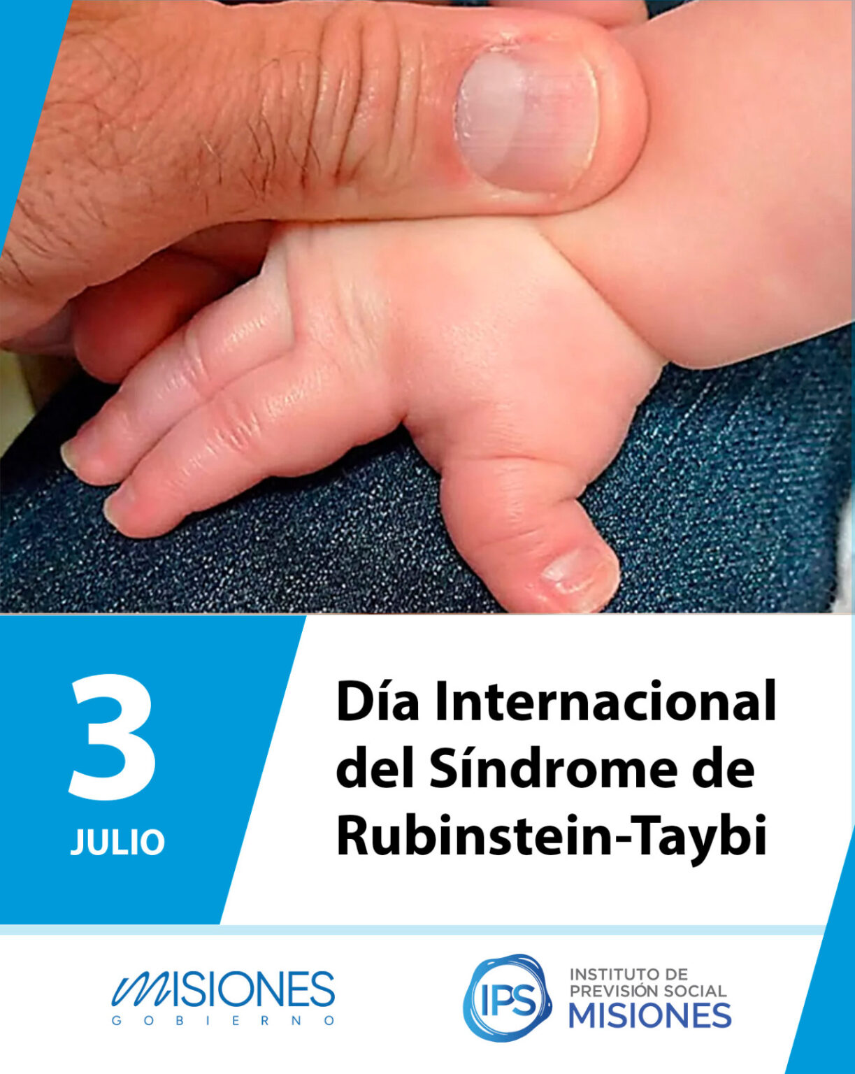 📒3 de julio | Día Internacional del Síndrome de Rubinstein-Taybi imagen-7