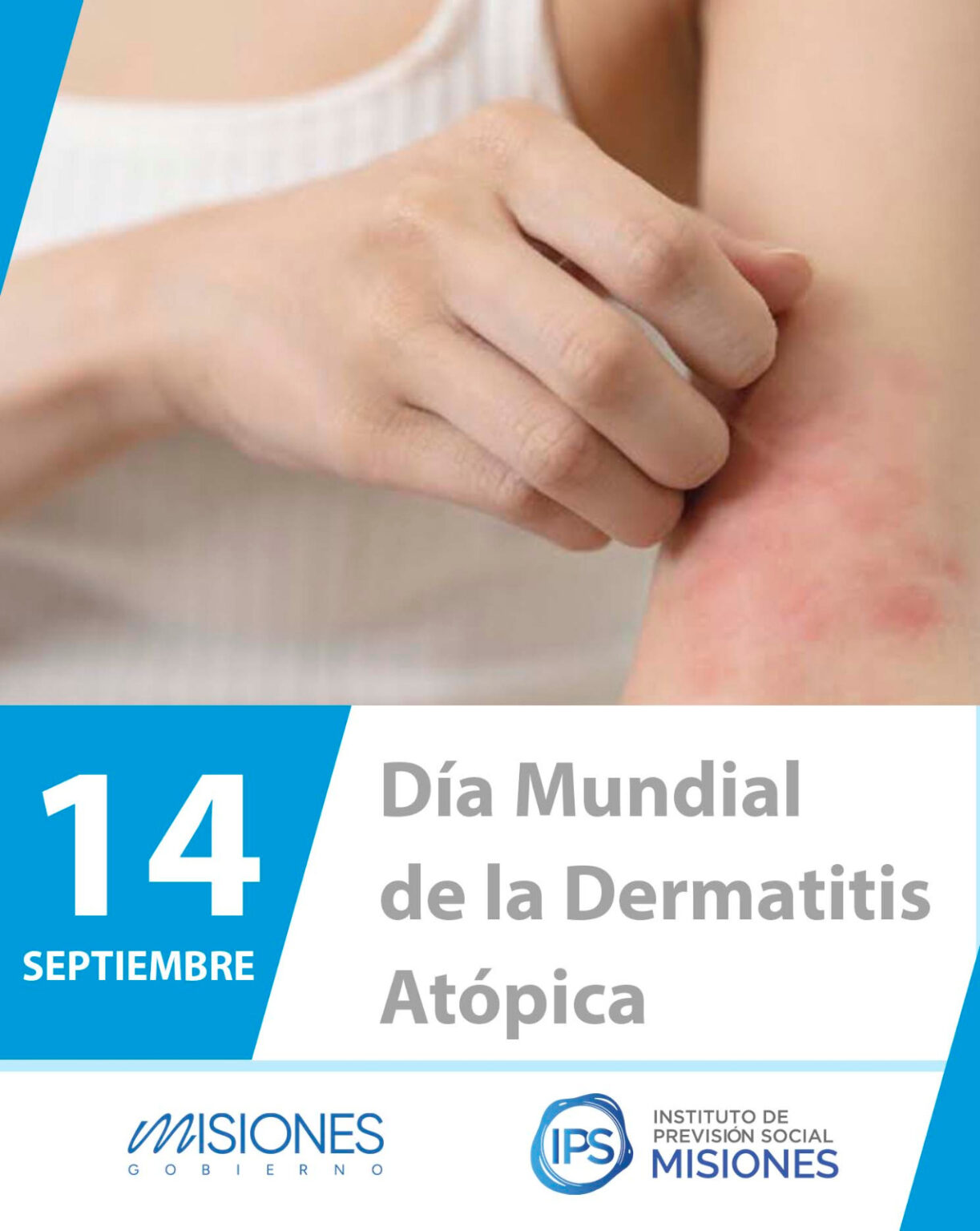 🩷 14 de septiembre | Día Mundial de la Dermatitis Atópica imagen-8