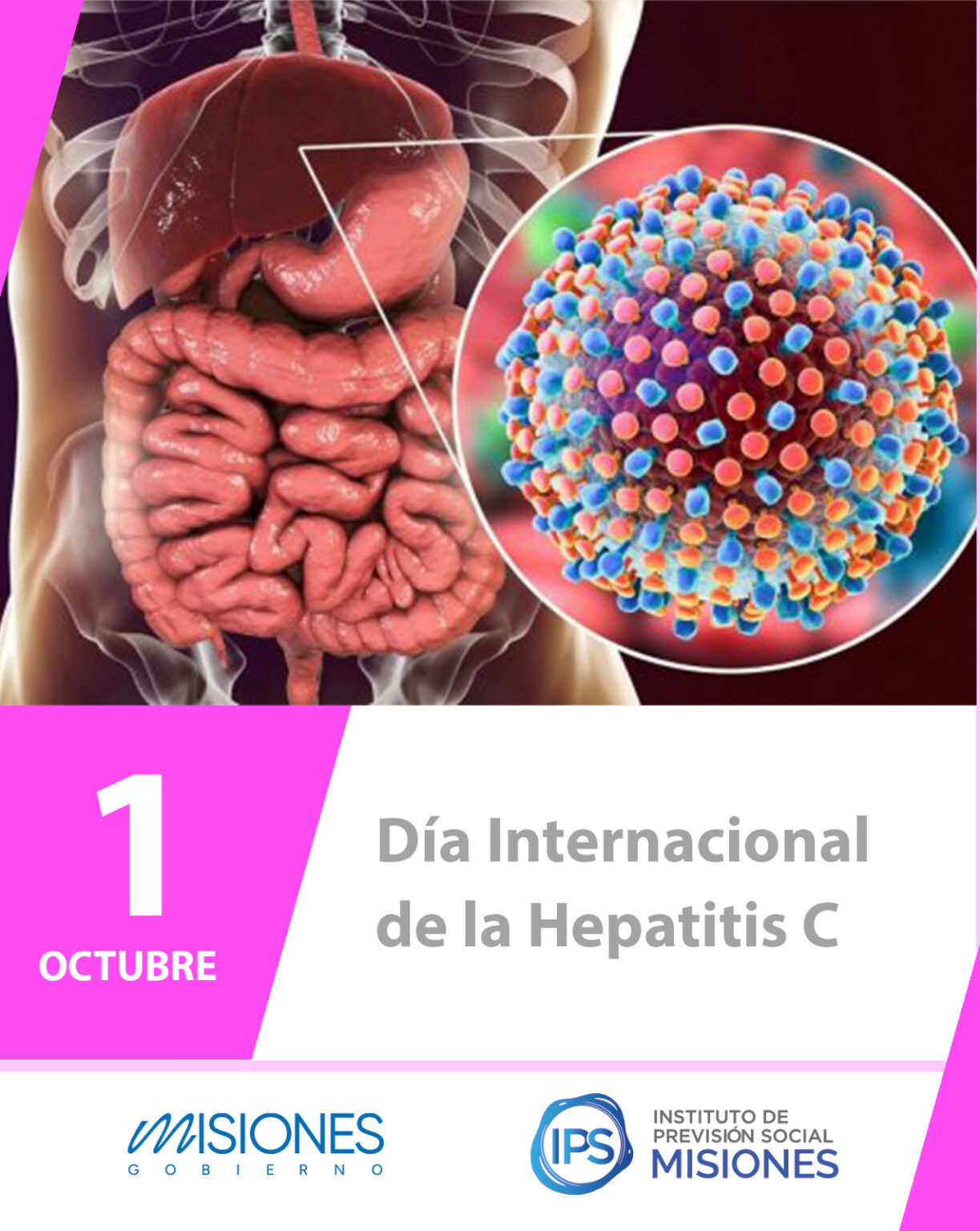 🧬 1 de octubre | Día Internacional de la Hepatitis C imagen-8